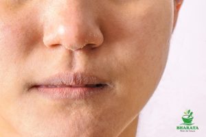 bibir kering