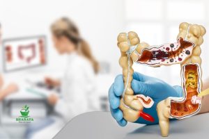 cara mengobati infeksi radang usus