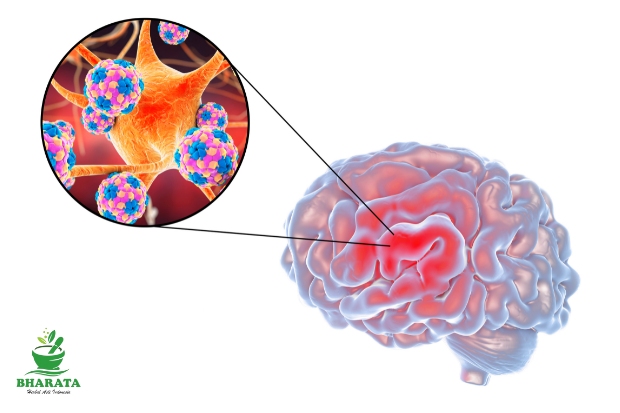 meningitis